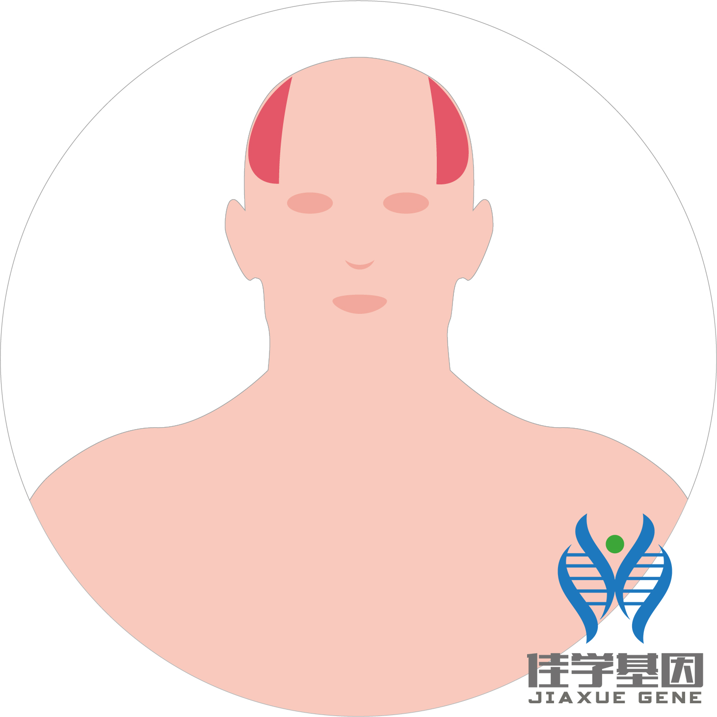 【佳學(xué)基因檢測】男性<font color='red'>脫發(fā)</font>（Androgenetic alopecia）基因解碼、<a href=http://m.floridacomunitycollege.com/tk/jiema/cexujishu/2021/31933.html>基因檢測</a>